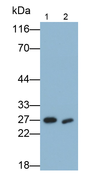 Polyclonal Antibody to B-Cell Leukemia/Lymphoma 2 (Bcl2)