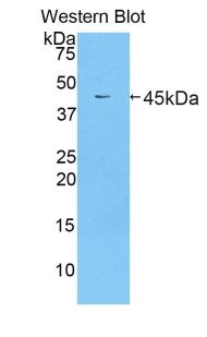 Polyclonal Antibody to Lactoferrin (LTF)