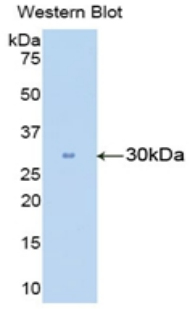 Polyclonal Antibody to Carbonic Anhydrase II (CA2)