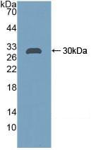 Polyclonal Antibody to Carbonic Anhydrase II (CA2)