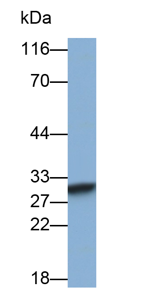 Polyclonal Antibody to Carbonic Anhydrase II (CA2)