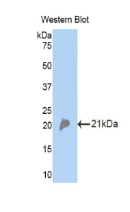 Polyclonal Antibody to Complement Factor P (CFP)