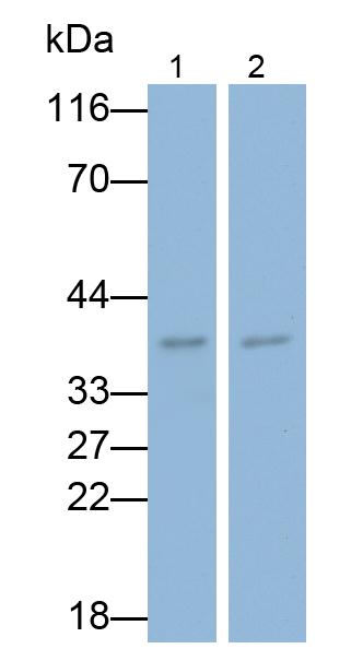 Polyclonal Antibody to Programmed Cell Death Protein 1 Ligand 1 (PDL1)