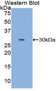 Polyclonal Antibody to Topoisomerase II (TOP2)