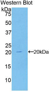 Polyclonal Antibody to Cyclin Dependent Kinase Inhibitor 2A (CDKN2A)