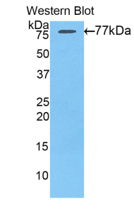 Polyclonal Antibody to Angiotensinogen (AGT)