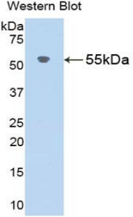 Polyclonal Antibody to Angiotensinogen (AGT)