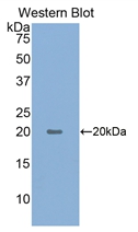 Polyclonal Antibody to Hypoxia Inducible Factor 1 Alpha (HIF1a)