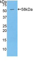 Polyclonal Antibody to Pregnancy Associated Plasma Protein A (PAPPA)