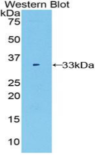 Polyclonal Antibody to Fucosidase Alpha L1, Tissue (FUCa1)