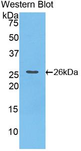 Polyclonal Antibody to Cardiotrophin 1 (CT1)