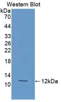 Polyclonal Antibody to Cholesteryl Ester Transfer Protein (CETP)