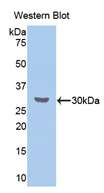 Polyclonal Antibody to Cholesteryl Ester Transfer Protein (CETP)