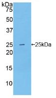 Polyclonal Antibody to Nitric Oxide Synthase 1, Neuronal (NOS1)