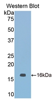 Polyclonal Antibody to Nitric Oxide Synthase 1, Neuronal (NOS1)