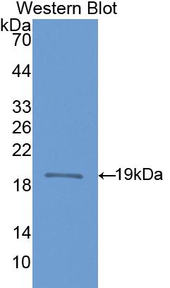 Polyclonal Antibody to Nitric Oxide Synthase 1, Neuronal (NOS1)