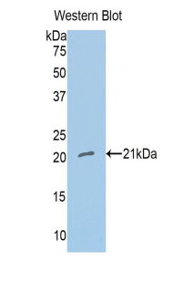 Polyclonal Antibody to Nitric Oxide Synthase 1, Neuronal (NOS1)