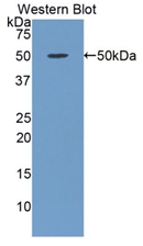 Polyclonal Antibody to Alpha-1-Acid Glycoprotein (a1AGP)