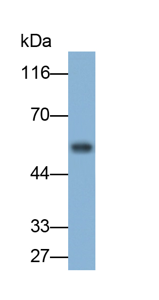 Polyclonal Antibody to Alpha-1-Acid Glycoprotein (a1AGP)