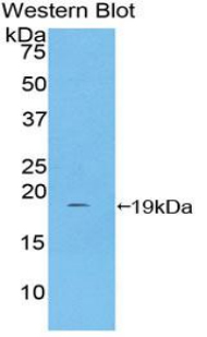 Polyclonal Antibody to Haptoglobin (Hpt)