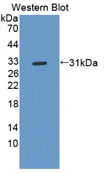 Polyclonal Antibody to Haptoglobin (Hpt)