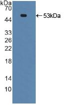 Polyclonal Antibody to Death receptor 5 (DR5)