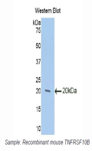 Polyclonal Antibody to Death receptor 5 (DR5)