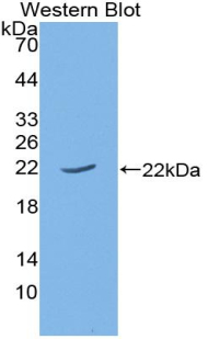 Polyclonal Antibody to Parathyroid Hormone Related Protein (PTHrP)