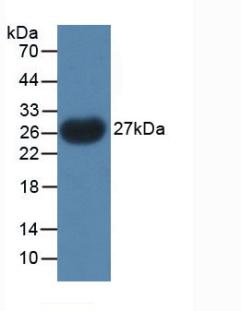 Polyclonal Antibody to Parathyroid Hormone Related Protein (PTHrP)