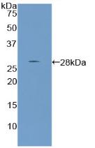 Polyclonal Antibody to Parathyroid Hormone Related Protein (PTHrP)