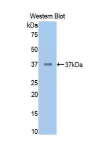 Polyclonal Antibody to Coagulation Factor II (F2)