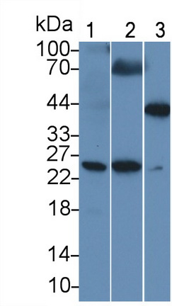 Polyclonal Antibody to C Reactive Protein (CRP)