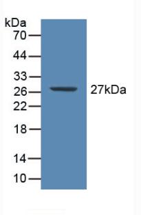 Polyclonal Antibody to C Reactive Protein (CRP)