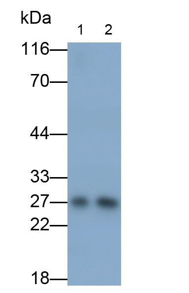 Polyclonal Antibody to C Reactive Protein (CRP)