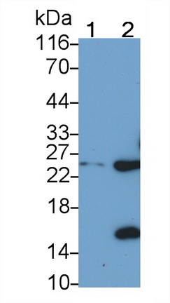 Polyclonal Antibody to C Reactive Protein (CRP)