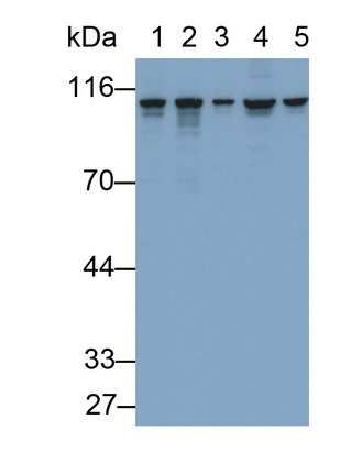 Polyclonal Antibody to Heat Shock Protein 90kDa Beta 1 (HSP90b1)