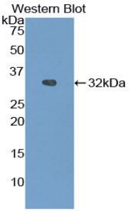 Polyclonal Antibody to Heat Shock Protein 90kDa Beta 1 (HSP90b1)