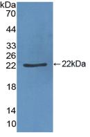 Polyclonal Antibody to Von Willebrand Factor (vWF)