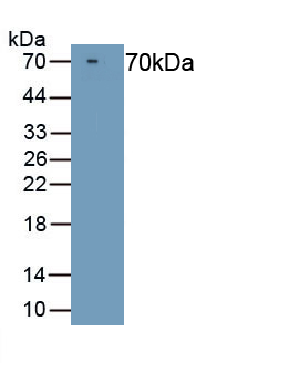 Polyclonal Antibody to Coagulation Factor X (F10)