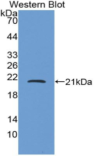 Polyclonal Antibody to Corticotropin Releasing Factor (CRF)