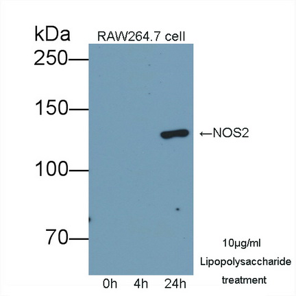 Polyclonal Antibody to Nitric Oxide Synthase 2, Inducible (NOS2)