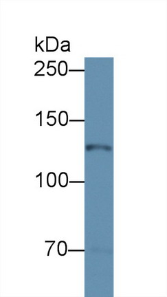 Polyclonal Antibody to Nitric Oxide Synthase 2, Inducible (NOS2)