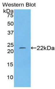 Polyclonal Antibody to Nitric Oxide Synthase 2, Inducible (NOS2)