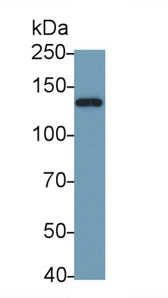 Polyclonal Antibody to Nitric Oxide Synthase 2, Inducible (NOS2)