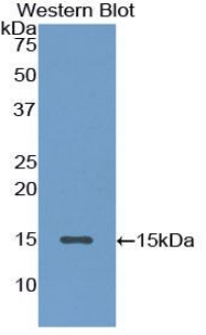 Polyclonal Antibody to Inhibin Beta A (INHbA)