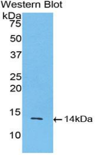 Polyclonal Antibody to Inhibin Beta A (INHbA)