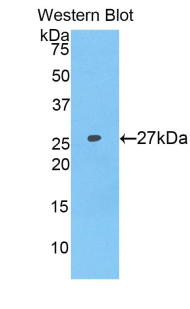 Polyclonal Antibody to Coagulation Factor IX (F9)