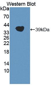 Polyclonal Antibody to Lipoprotein, a (Lpa)