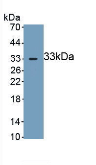 Polyclonal Antibody to Glycogen Phosphorylase, Brain (PYGB)