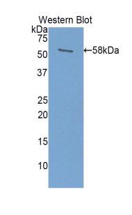 Polyclonal Antibody to Prolactin (PRL)